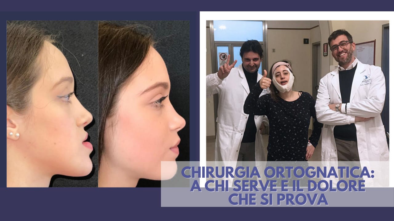 Chirurgia Ortognatica a Roma - OrtognaticaRoma