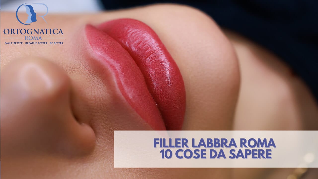 Filler labbra a Roma: 10 cose che devi sapere - OrtognaticaRoma