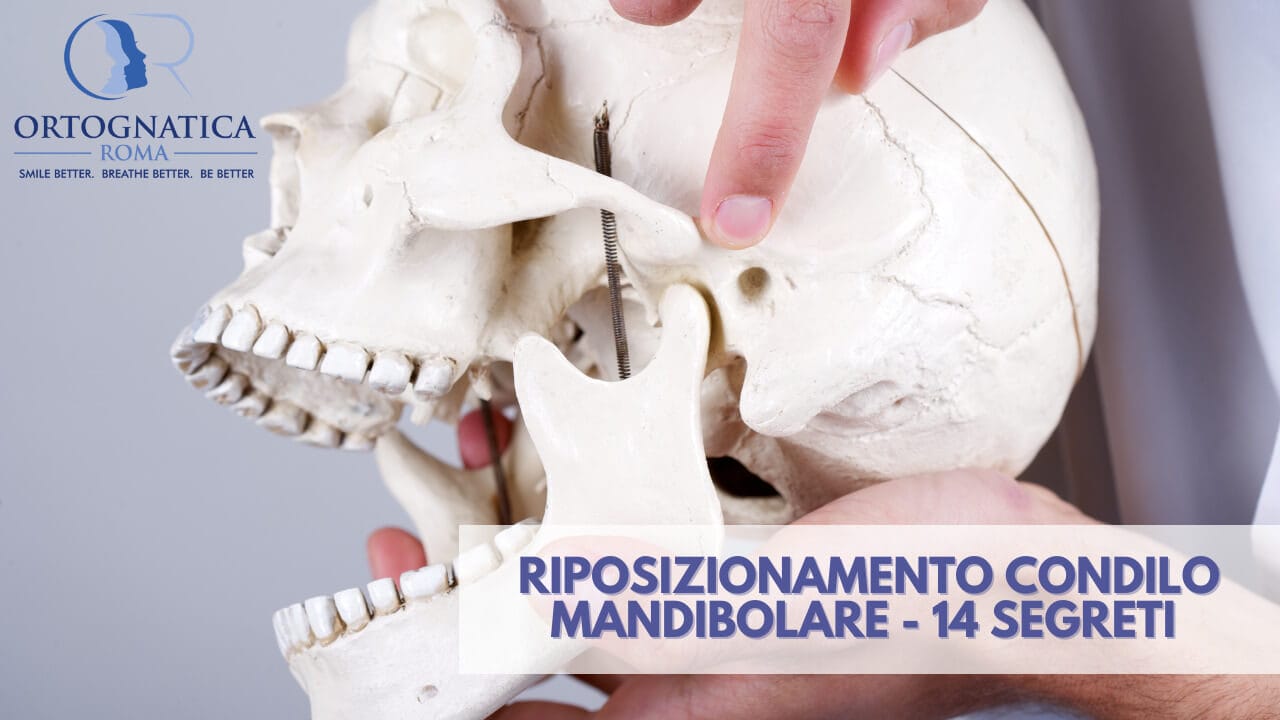 Riposizionamento condilo-mandibolare: 14 segreti - OrtognaticaRoma